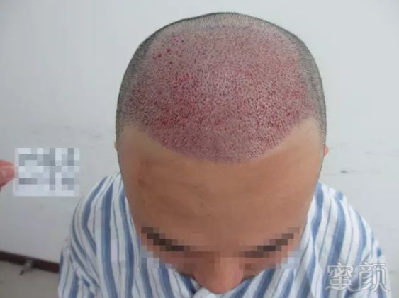 https://img.miyanlife.com/mnt/timg/180330/1131352W7-2.jpg