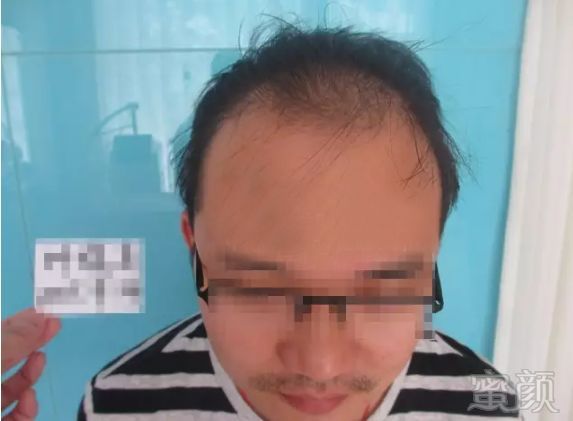 https://img.miyanlife.com/mnt/timg/180330/1131356454-0.jpg