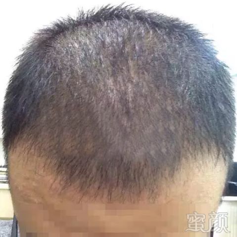 https://img.miyanlife.com/mnt/timg/180330/11313B054-4.jpg