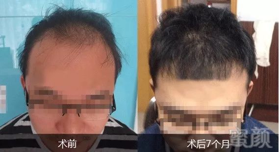https://img.miyanlife.com/mnt/timg/180330/1131402S0-11.jpg