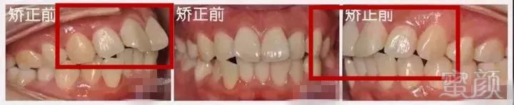 https://img.miyanlife.com/mnt/timg/180330/11412352T-14.jpg