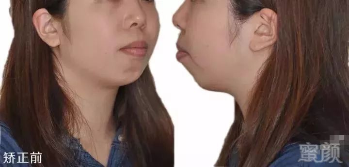 https://img.miyanlife.com/mnt/timg/180330/114123N01-13.jpg