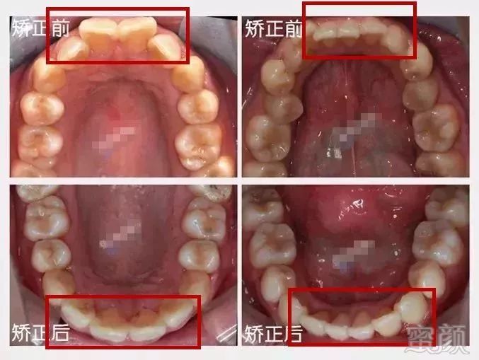 https://img.miyanlife.com/mnt/timg/180330/1141254L2-19.jpg