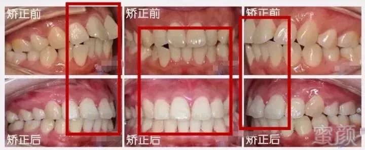 https://img.miyanlife.com/mnt/timg/180330/1141255624-21.jpg