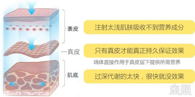 https://img.miyanlife.com/mnt/timg/180330/1142024915-8.jpg