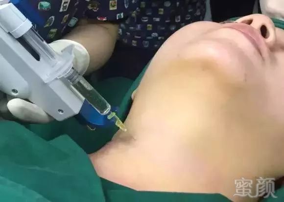 https://img.miyanlife.com/mnt/timg/180330/11420GH6-10.jpg