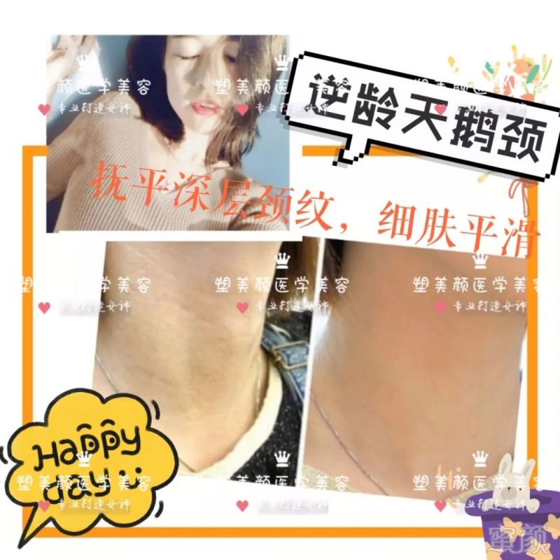 https://img.miyanlife.com/mnt/timg/180330/1142103F6-14.jpg
