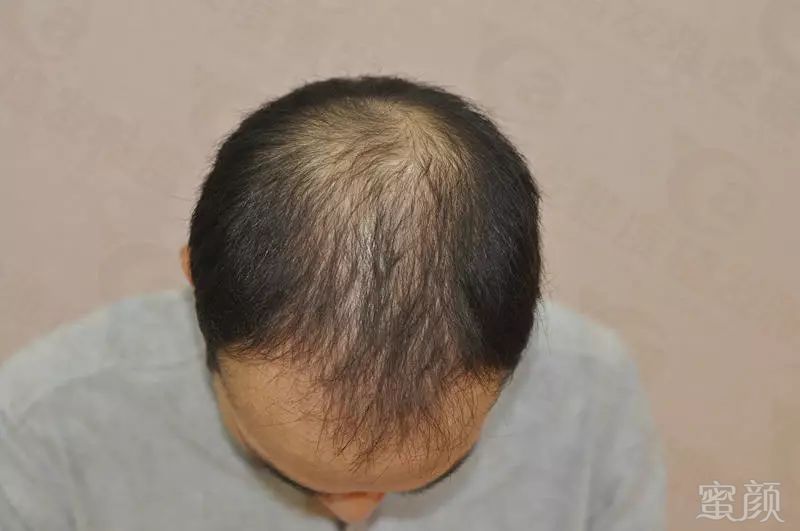 https://img.miyanlife.com/mnt/timg/180330/11492J4I-0.jpg
