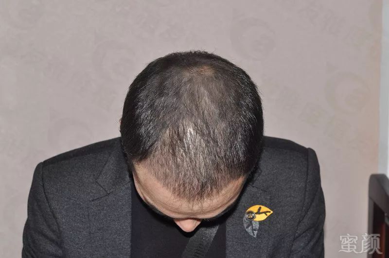https://img.miyanlife.com/mnt/timg/180330/114934A44-9.jpg