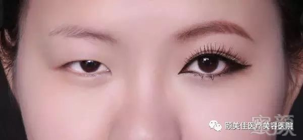 https://img.miyanlife.com/mnt/timg/180330/120T54Y9-5.jpg