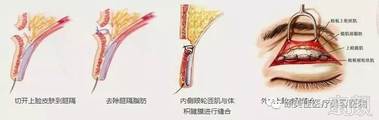 https://img.miyanlife.com/mnt/timg/180330/120T62244-6.jpg