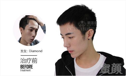 https://img.miyanlife.com/mnt/timg/180331/11313VT3-0.jpg
