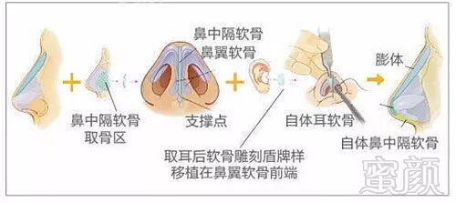 案例图片