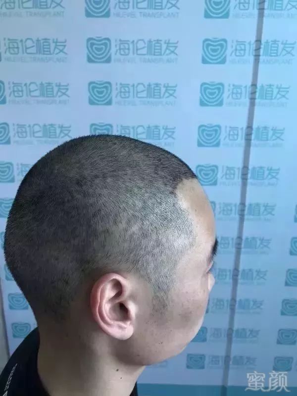 https://img.miyanlife.com/mnt/timg/180331/115H92K5-10.jpg