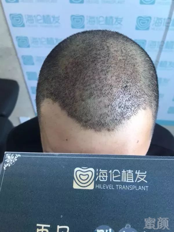 https://img.miyanlife.com/mnt/timg/180331/115HS543-9.jpg