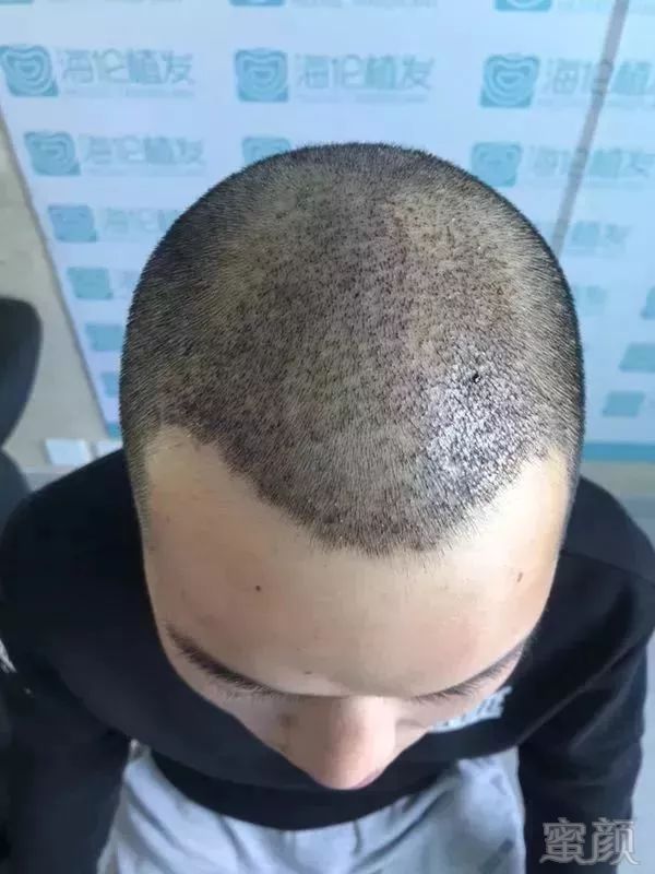 https://img.miyanlife.com/mnt/timg/180331/115HU540-7.jpg