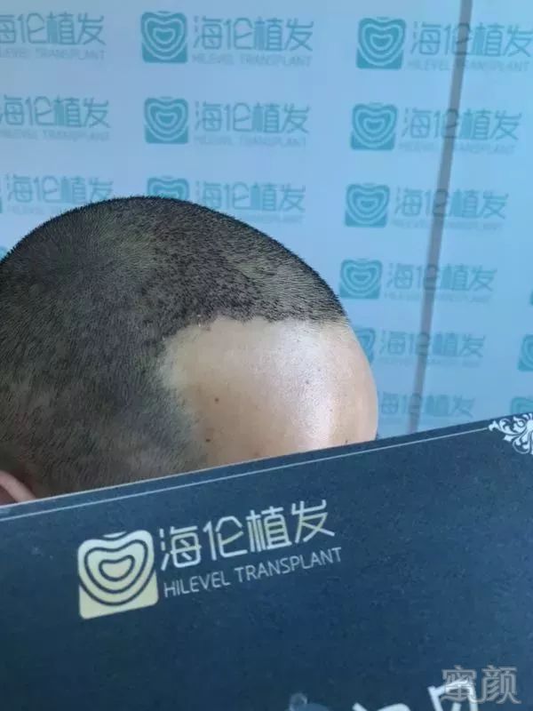 https://img.miyanlife.com/mnt/timg/180331/115HW3G-8.jpg