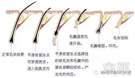 https://img.miyanlife.com/mnt/timg/180331/12225330U-2.jpg