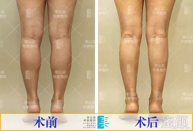 https://img.miyanlife.com/mnt/timg/180331/1254251107-9.jpg