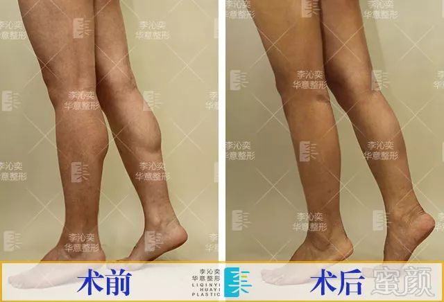 https://img.miyanlife.com/mnt/timg/180331/1254254961-10.jpg