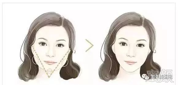 https://img.miyanlife.com/mnt/timg/180331/13142AK6-4.jpg