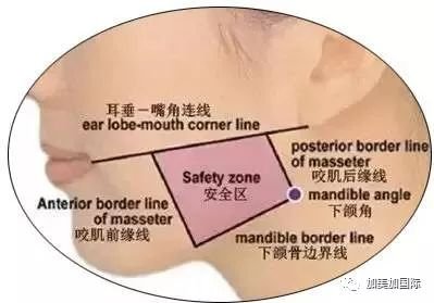 https://img.miyanlife.com/mnt/timg/180331/13142M011-9.jpg