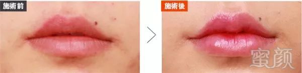 https://img.miyanlife.com/mnt/timg/180331/1320004594-4.jpg