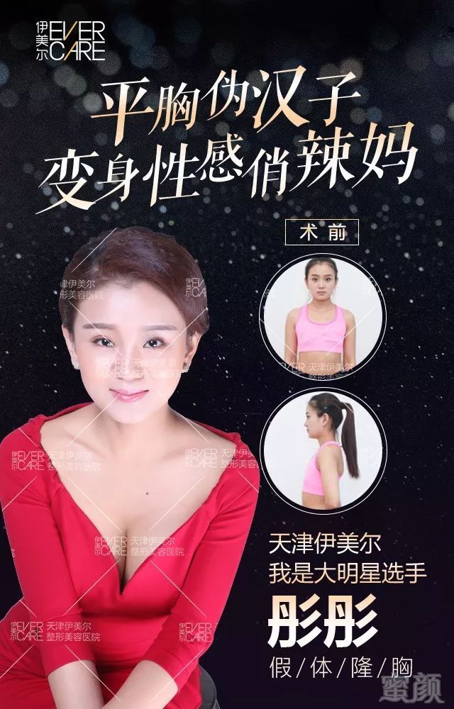 https://img.miyanlife.com/mnt/timg/180401/1144016015-0.jpg