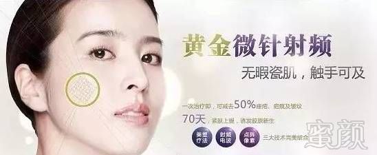 https://img.miyanlife.com/mnt/timg/180401/1145103N6-1.jpg