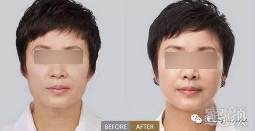 https://img.miyanlife.com/mnt/timg/180401/1145113037-5.jpg