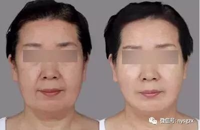 https://img.miyanlife.com/mnt/timg/180401/1145131952-6.jpg