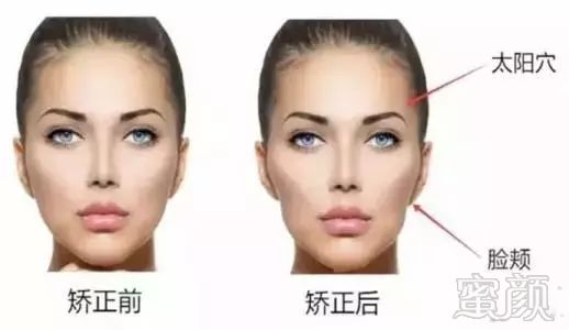 https://img.miyanlife.com/mnt/timg/180401/1211291912-2.jpg