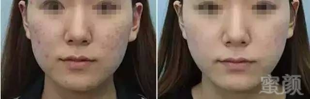https://img.miyanlife.com/mnt/timg/180401/122J26116-20.jpg