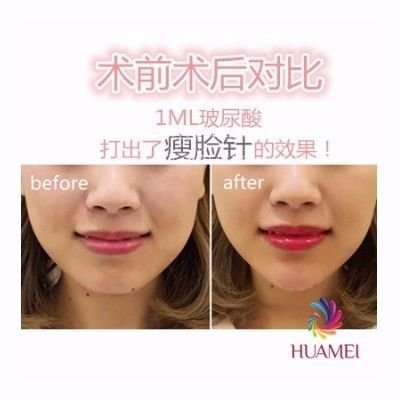 https://img.miyanlife.com/mnt/timg/180401/1300563296-3.jpg