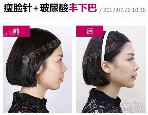https://img.miyanlife.com/mnt/timg/180401/13005A132-4.jpg