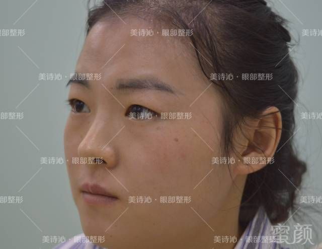 https://img.miyanlife.com/mnt/timg/180401/1326164510-7.jpg