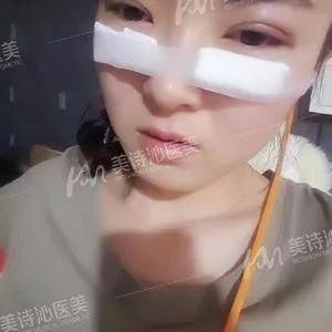 https://img.miyanlife.com/mnt/timg/180401/13261L3K-11.jpg