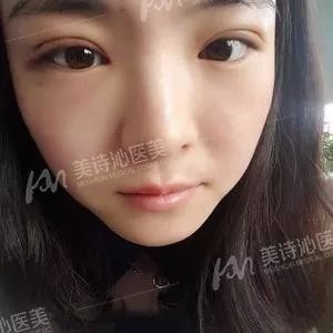 https://img.miyanlife.com/mnt/timg/180401/13261La4-12.jpg