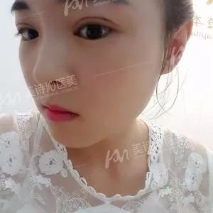 https://img.miyanlife.com/mnt/timg/180401/13261R935-13.jpg
