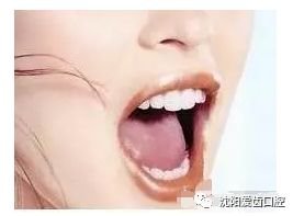 https://img.miyanlife.com/mnt/timg/180402/1013403F5-12.jpg