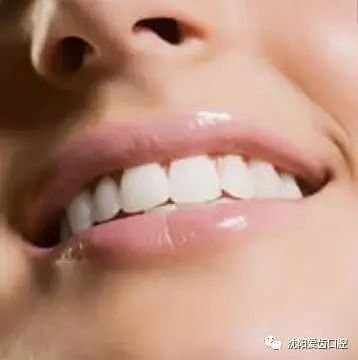 https://img.miyanlife.com/mnt/timg/180402/101340B60-14.jpg