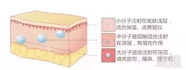 https://img.miyanlife.com/mnt/timg/180402/10154VS6-4.jpg