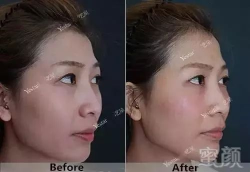 https://img.miyanlife.com/mnt/timg/180402/1015515608-13.jpg