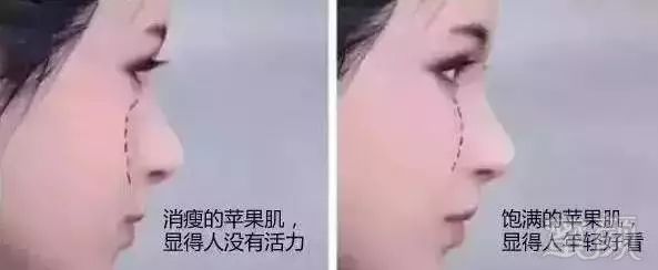 https://img.miyanlife.com/mnt/timg/180402/10242951N-14.jpg