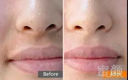 https://img.miyanlife.com/mnt/timg/180402/1039415939-14.jpg