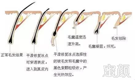 https://img.miyanlife.com/mnt/timg/180402/105SL4W-11.jpg