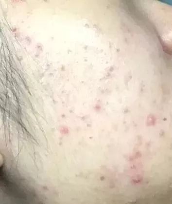 https://img.miyanlife.com/mnt/timg/180402/1100594462-3.jpg