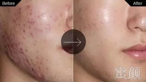 https://img.miyanlife.com/mnt/timg/180402/1101002N5-9.jpg
