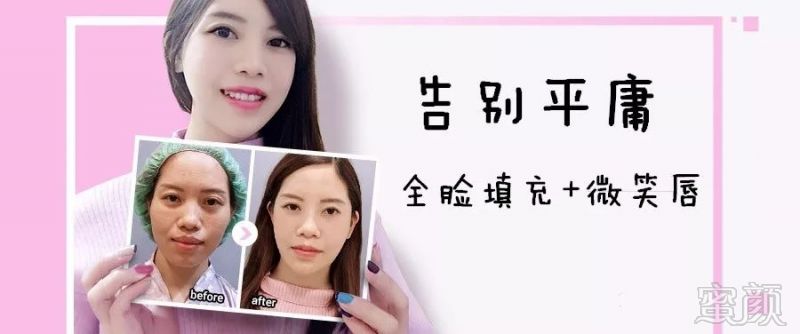 https://img.miyanlife.com/mnt/timg/180402/110JB052-0.jpg