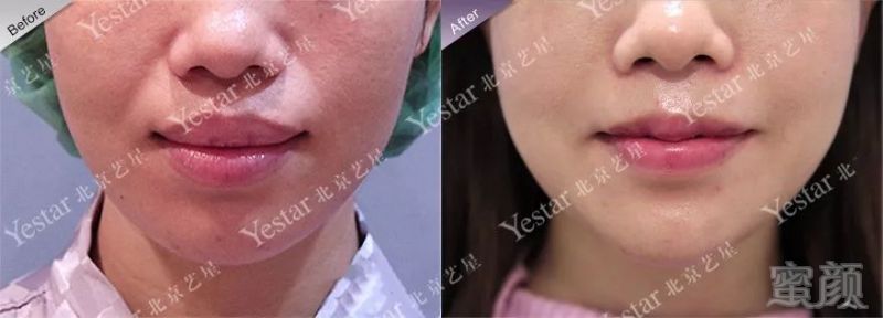 https://img.miyanlife.com/mnt/timg/180402/110K21915-5.jpg